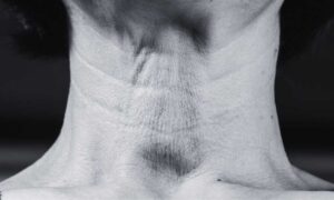 Scopri di più sull'articolo MINIMUM NECK